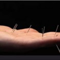 /products/curso-de-acropuntura-y-manopuntura-con-practicas/